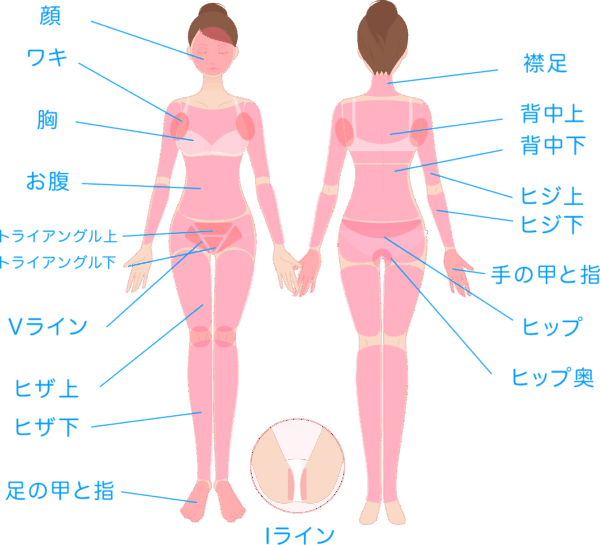 ミュゼ顔・VIO含む全⾝スキンケア美肌脱⽑コース脱毛範囲